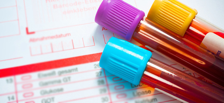 Vitamin B12 Test High Blood Levels