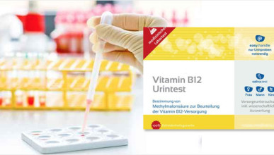 vitamin-b12-urine-test-785x360