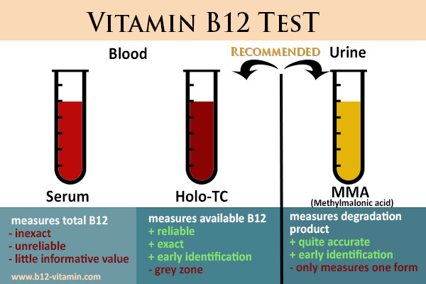 buiten gebruik uitzending dreigen Vitamin B12 - An Overview